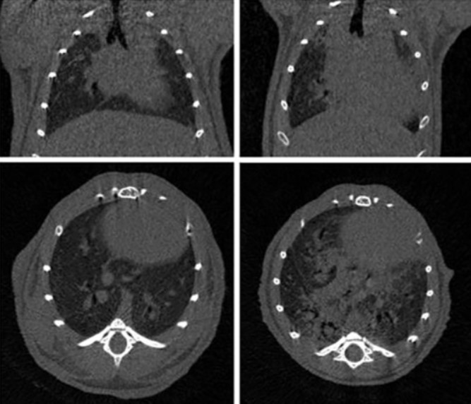 Longitudinal micro-CT provides biomarkers of lung disease that can be used to assess the effect of therapy in preclinical mouse models, and reveal compensatory changes in lung volume